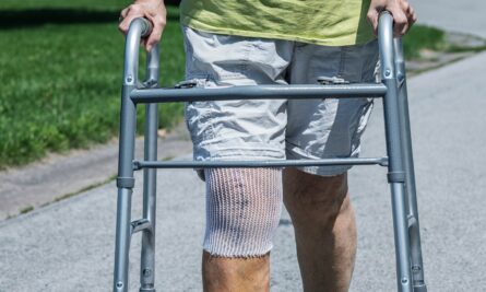 cost of knee replacement surgery